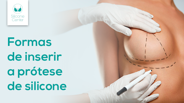 Marcação do seio pelo cirurgião para definir a forma de inserir a prótese de silicone nas mamas